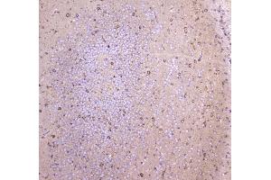 IHC analysis of WWOX using anti-WWOX antibody . (WWOX anticorps  (AA 1-245))