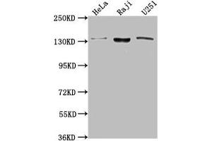 Western Blot Positive WB detected in: Hela whole cell lysate, Raji whole cell lysate, U251 whole cell lysate All lanes: LARS antibody at 1:2000 Secondary Goat polyclonal to rabbit IgG at 1/50000 dilution Predicted band size: 135, 129, 56 kDa Observed band size: 135 kDa (LARS anticorps  (AA 614-892))