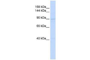 RAD54B antibody used at 1 ug/ml to detect target protein. (RAD54B anticorps)