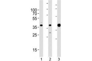 Western blot analysis of lysate from 1) MCF-7, 2) HeLa cell line and 3) human skeletal muscle tissue lysate using ALDOA antibody at 1:1000.
