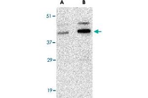 Western blot analysis of CCNO in human bladder tissue lysate with CCNO polyclonal antibody  at (A) 1 and (B) 2 ug/mL . (Cyclin O anticorps  (Internal Region))
