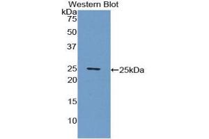 Western Blotting (WB) image for anti-C-Reactive Protein (CRP) (AA 20-222) antibody (ABIN1077881) (CRP anticorps  (AA 20-222))