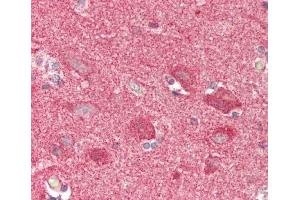 Formalin-fixed and paraffin-embedded H.