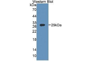 Detection of Recombinant ABCF1, Human using Polyclonal Antibody to ATP Binding Cassette Transporter F1 (ABCF1) (ABCF1 anticorps  (AA 625-845))