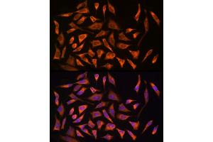 Immunofluorescence analysis of HeLa cells using NOD2 Rabbit pAb (ABIN7269065) at dilution of 1:150 (40x lens).