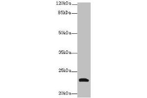 Western blot All lanes: YKT6 antibody at 12 μg/mL + A549 whole cell lysate Secondary Goat polyclonal to rabbit IgG at 1/10000 dilution Predicted band size: 23, 19 kDa Observed band size: 23 kDa (YKT6 anticorps  (AA 10-195))
