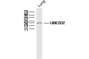 Mouse lung lysates probed with UBE2D2 Polyclonal Antibody, Unconjugated  at 1:300 dilution and 4˚C overnight incubation. (UBE2D2 anticorps  (AA 31-130))