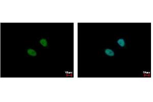 ICC/IF Image MSL3L1 antibody detects MSL3L1 protein at nucleus by immunofluorescent analysis.