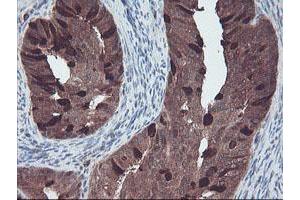 Image no. 2 for anti-RAB, Member of RAS Oncogene Family-Like 2A (RABL2A) antibody (ABIN1500575)