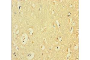 Immunohistochemistry of paraffin-embedded human brain tissue using ABIN7149094 at dilution of 1:100 (CYBB anticorps  (AA 283-570))