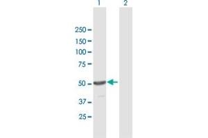 Western Blot analysis of TINF2 expression in transfected 293T cell line by TINF2 MaxPab polyclonal antibody. (TINF2 anticorps  (AA 1-451))