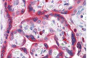 Anti-ADAM15 antibody IHC staining of human placenta.