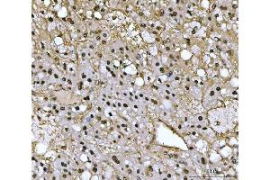 IHC analysis of PSMB4 using anti-PSMB4 antibody (ABIN7600532).