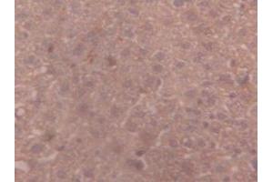 IHC-P analysis of Mouse Liver Tissue, with DAB staining. (alpha 2 Macroglobulin anticorps  (AA 1053-1214))