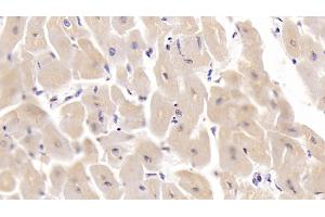 Detection of SHBG in Human Cardiac Muscle Tissue using Monoclonal Antibody to Sex Hormone Binding Globulin (SHBG) (SHBG anticorps  (AA 224-388))