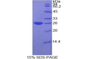 SDS-PAGE (SDS) image for Cardiotrophin 1 (CTF1) (AA 1-203) protein (His tag) (ABIN1079067) (Cardiotrophin 1 Protein (CTF1) (AA 1-203) (His tag))
