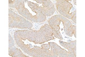 Immunohistochemistry (IHC) image for anti-Spectrin Beta, Non-Erythrocytic 1 (SPTBN1) (AA 2100-2150) antibody (ABIN7454694) (SPTBN1 anticorps  (AA 2100-2150))