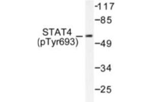 Image no. 1 for anti-Signal Transducer and Activator of Transcription 4 (STAT4) (pTyr693) antibody (ABIN318129) (STAT4 anticorps  (pTyr693))