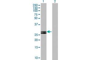 Western Blot analysis of HLA-DOB expression in transfected 293T cell line by HLA-DOB MaxPab polyclonal antibody. (HLA-DOB anticorps  (AA 1-273))