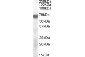 Western Blotting (WB) image for anti-Potassium Voltage-Gated Channel, KQT-Like Subfamily, Member 4 (KCNQ4) (Internal Region) antibody (ABIN2466703) (KCNQ4 anticorps  (Internal Region))