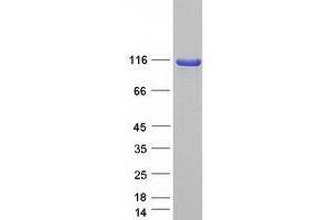 Validation with Western Blot