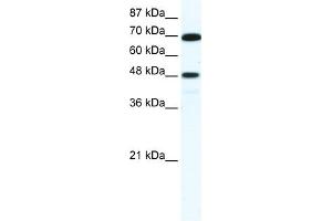 WB Suggested Anti-ZNF446 Antibody Titration:  5. (ZNF446 anticorps  (N-Term))