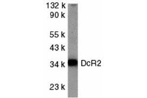 Western Blotting (WB) image for anti-Tumor Necrosis Factor Receptor Superfamily, Member 10d, Decoy with Truncated Death Domain (TNFRSF10D) (Cytoplasmic Domain) antibody (ABIN1030842) (DcR2 anticorps  (Cytoplasmic Domain))