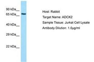 Image no. 1 for anti-AarF Domain Containing Kinase 2 (ADCK2) (AA 257-306) antibody (ABIN6749962) (ADCK2 anticorps  (AA 257-306))