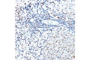 Immunohistochemistry of paraffin-embedded rat spleen using SP1 Rabbit pAb (ABIN7270506) at dilution of 1:50 (40x lens).