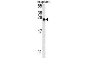 Western Blotting (WB) image for anti-EP300 Interacting Inhibitor of Differentiation 2 (EID2) antibody (ABIN3002400)