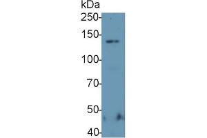 Detection of ZFHX1A in Hela cell lysate using Polyclonal Antibody to Zinc Finger Homeobox Protein 1A (ZFHX1A) (ZEB1 anticorps  (AA 904-1124))