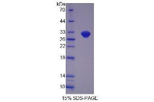 SDS-PAGE analysis of Mouse OVGP1 Protein. (OVGP1 Protéine)