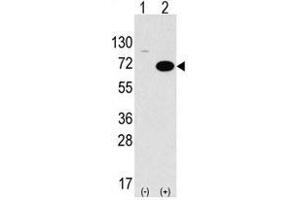 Image no. 1 for anti-serine threonine Kinase 39 (STK39) (C-Term) antibody (ABIN356942) (STK39 anticorps  (C-Term))