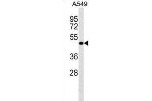 Western Blotting (WB) image for anti-Leucine Rich Repeat Containing 26 (LRRC26) antibody (ABIN2998660) (LRRC26 anticorps)