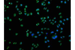Immunofluorescence staining of Hela cells with ABIN7150833 at 1:200, counter-stained with DAPI.