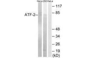 Western blot analysis of extracts from HeLa cells and 293 cells, using ATF-2 (Ab-472) antibody.