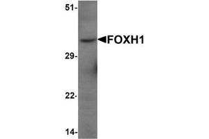 Western blot analysis of FOXH1 in human liver tissue lysate with FOXH1 Antibody  at 1 μg/mL (FOXH1 anticorps  (N-Term))