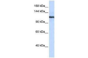 Western Blot showing PLA2G4B antibody used at a concentration of 1-2 ug/ml to detect its target protein. (PLA2G4B anticorps  (N-Term))