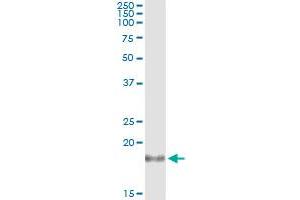 Immunoprecipitation of IL1RN transfected lysate using anti-IL1RN monoclonal antibody and Protein A Magnetic Bead , and immunoblotted with IL1RN MaxPab rabbit polyclonal antibody.