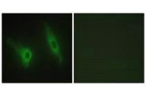Immunofluorescence analysis of HeLa cells, using CKI-ε antibody. (CK1 epsilon anticorps)