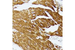 Immunohistochemistry of paraffin-embedded mouse heart using COX15 antibody (ABIN7266634) at dilution of 1:100 (40x lens).