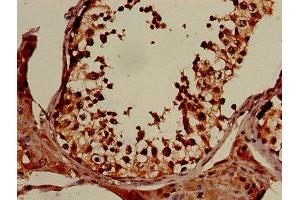 IHC image of ABIN7152317 diluted at 1:150 and staining in paraffin-embedded human testis tissue performed on a Leica BondTM system.