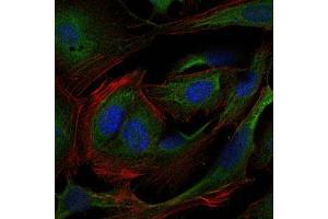 Immunofluorescence analysis of 3T3-L1 cells using CRK mouse mAb (green). (Crk anticorps)
