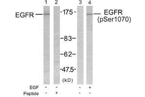 Western blot analysis of extract from SK-OV3 cells untreated or treated with EGF using EGFR (Ab-1070) antibody (E021073, Lane 1 and 2) and EGFR (phospho-Ser1070) antibody (E011080, Lane 3 and 4). (EGFR anticorps)