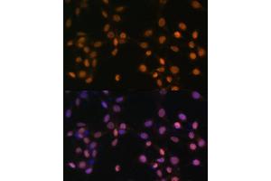 Immunofluorescence analysis of NIH/3T3 cells using c-Jun antibody (ABIN3020776, ABIN3020777, ABIN1513116 and ABIN6213718) at dilution of 1:100. (C-JUN anticorps  (AA 1-70))