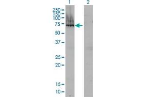Western Blot analysis of AFP expression in transfected 293T cell line by AFP monoclonal antibody (M01), clone 1G7.