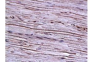 Formalin-fixed and paraffin embedded: rat sciatic nerve labeled with Anti-AGER/RAGE Polyclonal Antibody, Unconjugated (ABIN725900) at 1:200 followed by conjugation to the secondary antibody and DAB staining