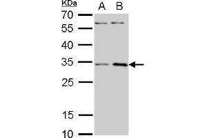 WB Image RPS3A antibody detects RPS3A protein by Western blot analysis. (RPS3A anticorps)