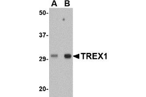 Western Blotting (WB) image for anti-three Prime Repair Exonuclease 1 (TREX1) (Middle Region) antibody (ABIN1031144) (TREX1 anticorps  (Middle Region))