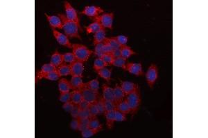 IF analysis of QPRT using anti-QPRT antibody (ABIN7600821). (QPRT anticorps  (AA 24-297))